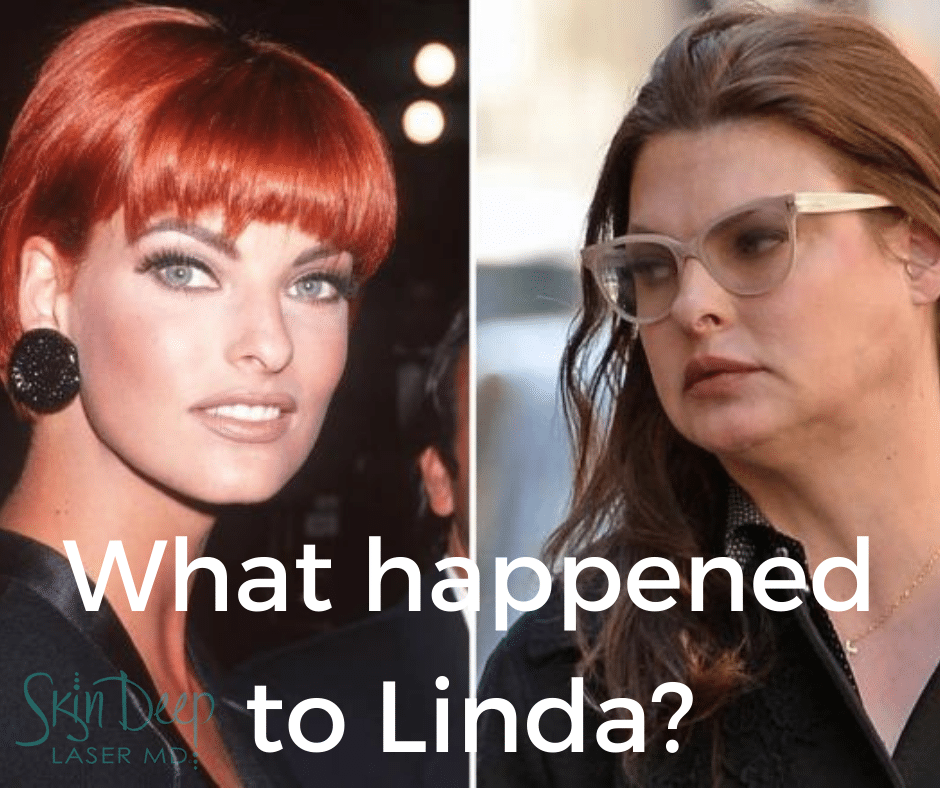 What happened to Linda