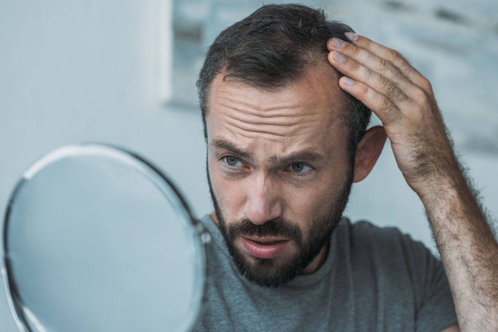 Man inspect hair loss in the mirror, thinking about hair restoration options.